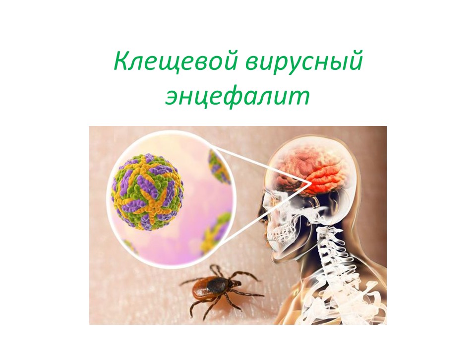 КВЭ